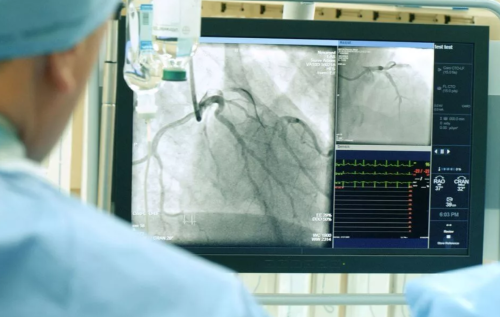 Особенности МР-ангиографии сердца