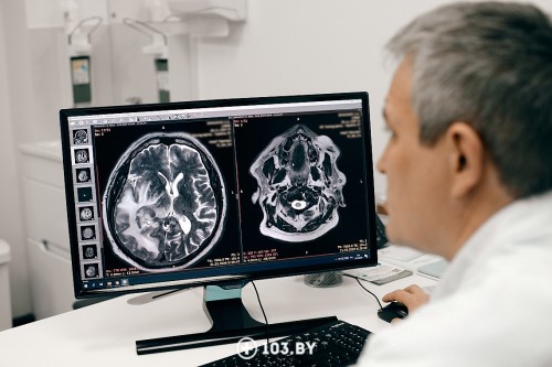 МРТ гипофиза - диагностика головокружений