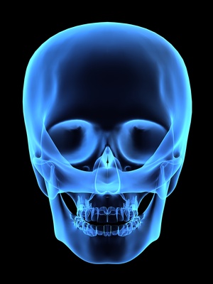 компьюерная томография челюсти